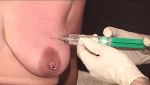Injected tits