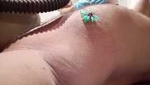 Today I'm testing if subject 1401 can take 30 needles in one nipple. Will he make 30 needles or won't his nipples be big enough?
