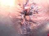 Penalty wax of the slave rosette