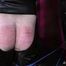 Severe Caning